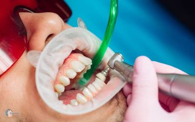 Benefits of a clean and healthy mouth