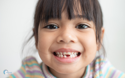 Treatment of a broken tooth