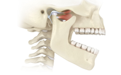 TM joint pain